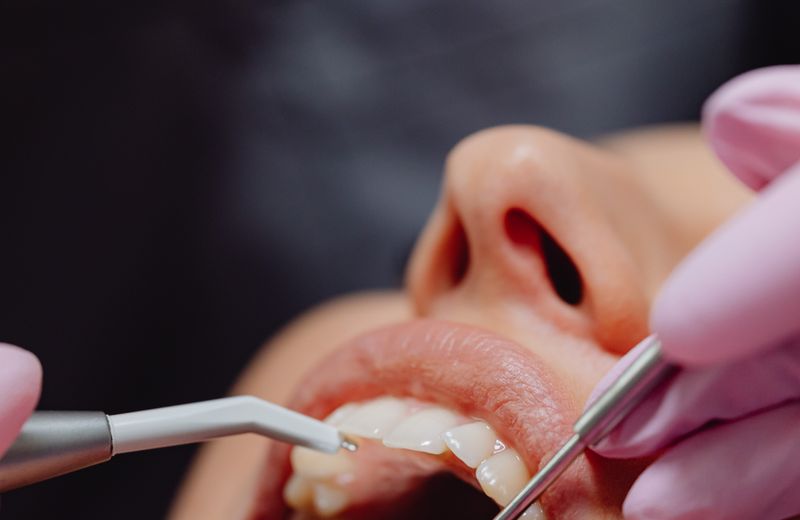 Dentist examining a patient gums with a mirror and probe